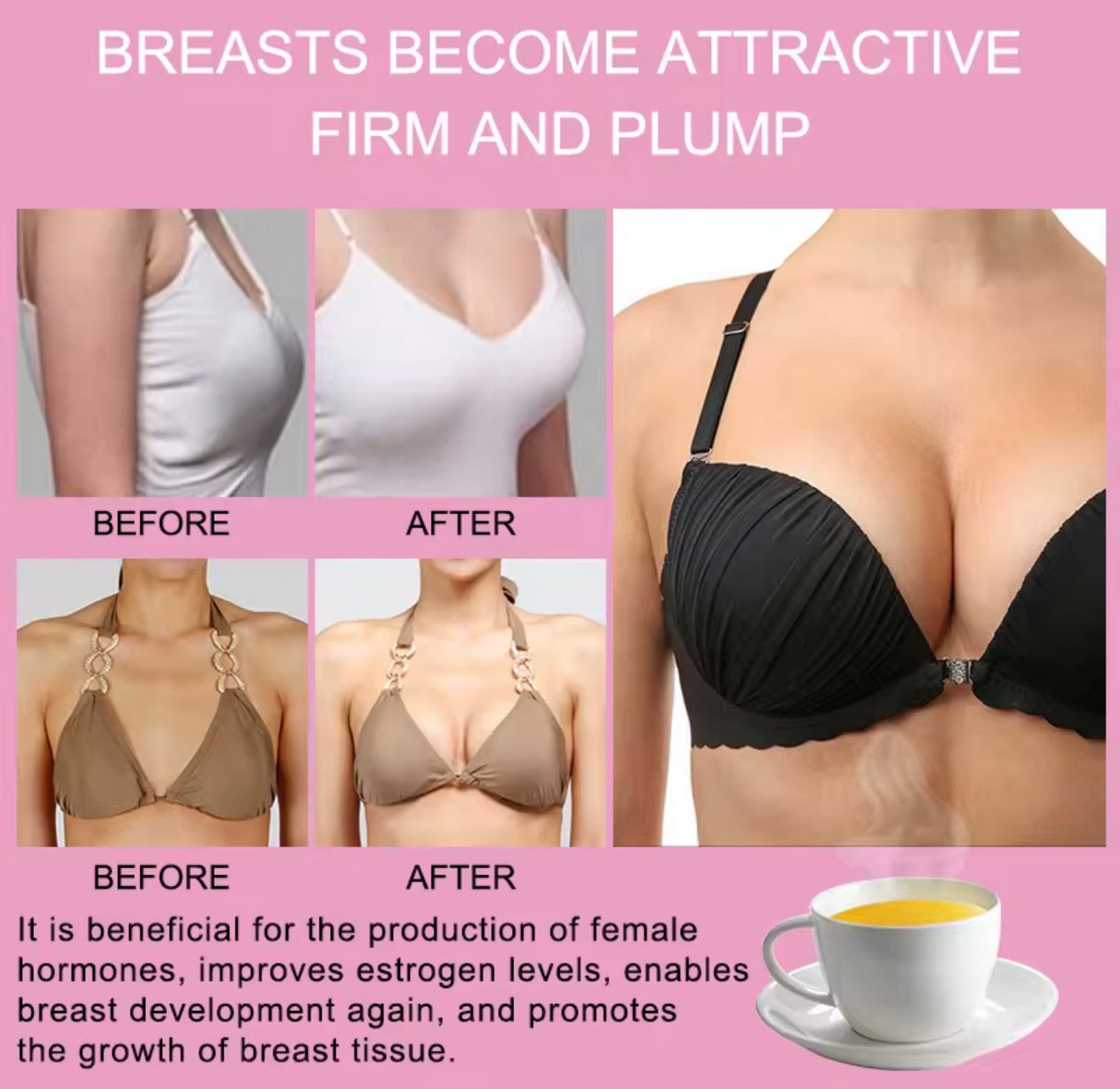 Breast